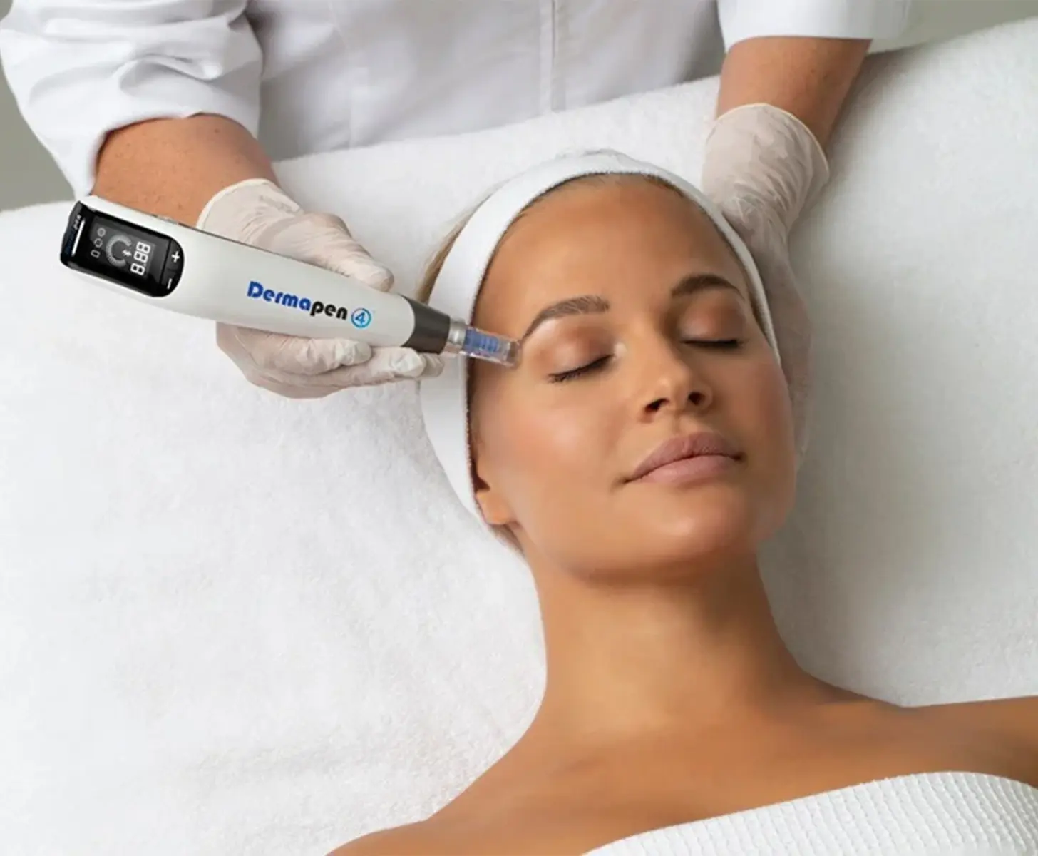Client receiving microneedling treatment for skin rejuvenation